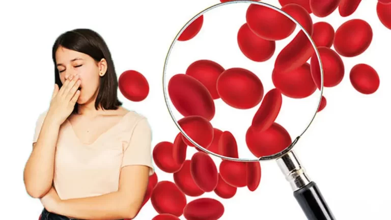 Anemia in Women – Causes and Symptoms