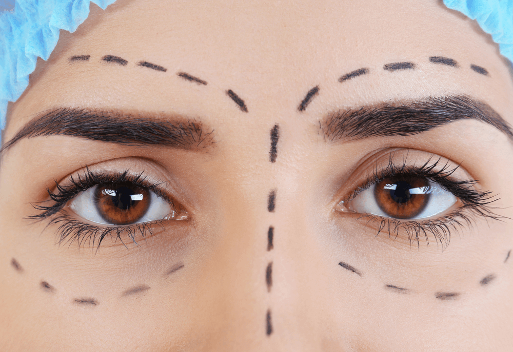 Risks of Getting Your Eyebrows Threaded After Botox