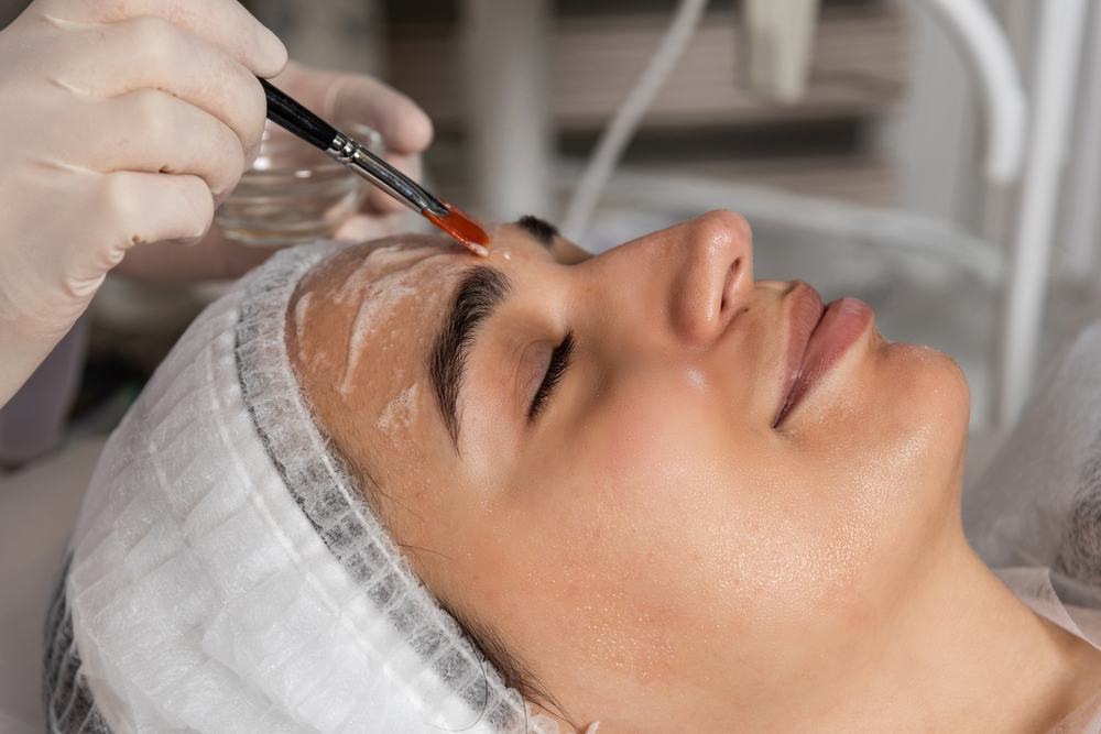 Eyebrow Threading After Chemical Peel